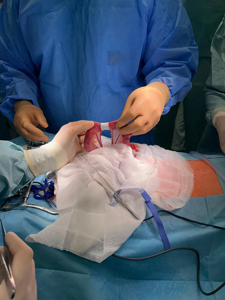 Aplikace naplasti Nanoflexion kolem strev.jpeg