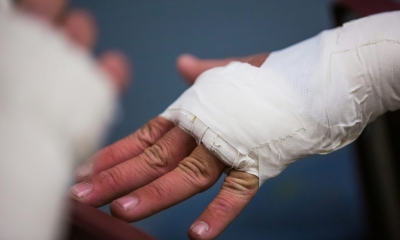 Náhled článku: Ústav chirurgie ruky letos oslavil půlstoletí. Dnes patří ke špičkám v oboru