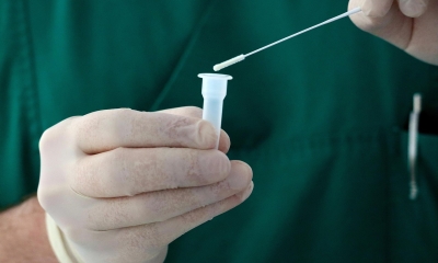 Náhled článku: HPV DNA test pomáhá odhalit riziko rakoviny děložního čípku. Komu ho pojišťovna hradí?