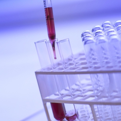 Náhled článku mobil: HPV DNA test pomáhá odhalit riziko rakoviny děložního čípku. Komu ho pojišťovna hradí?